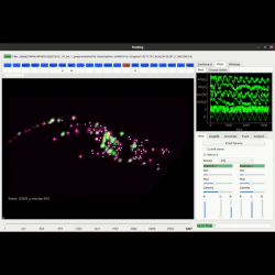 Automated neuron tracking inside moving and deforming animals using deep learning and targeted augmentation